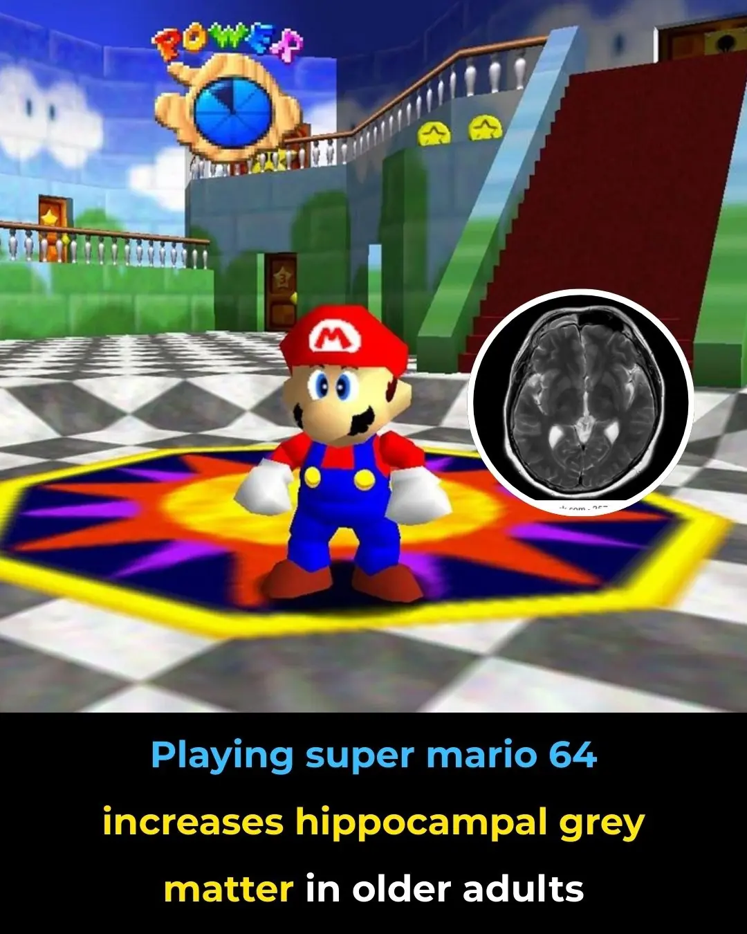 Three-Dimensional Video Gaming and Hippocampal Plasticity in Older Adults