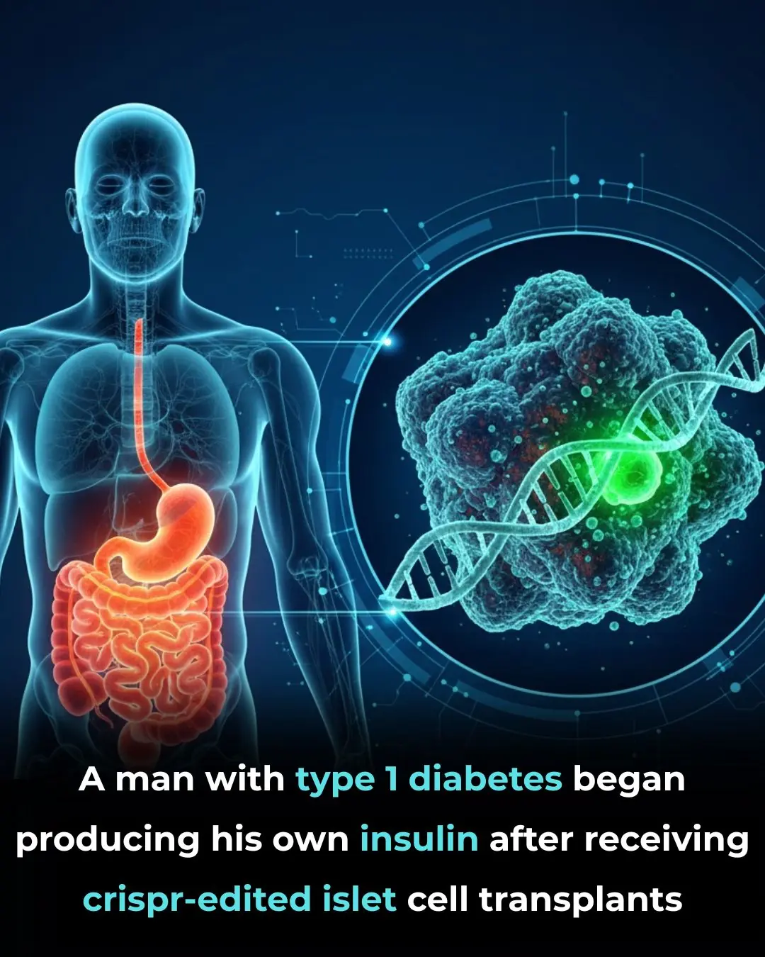 CRISPR-Edited Islet Cell Transplantation: A New Therapeutic Horizon for Type 1 Diabetes