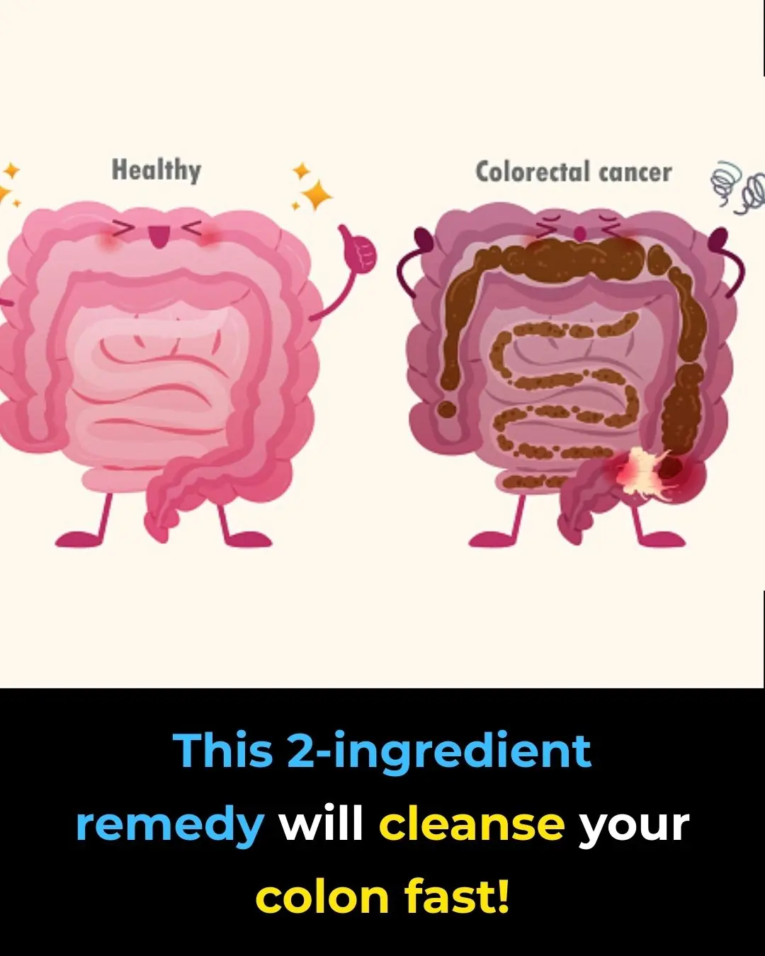 Colon Cleansing With Kefir and Flaxseed Meal