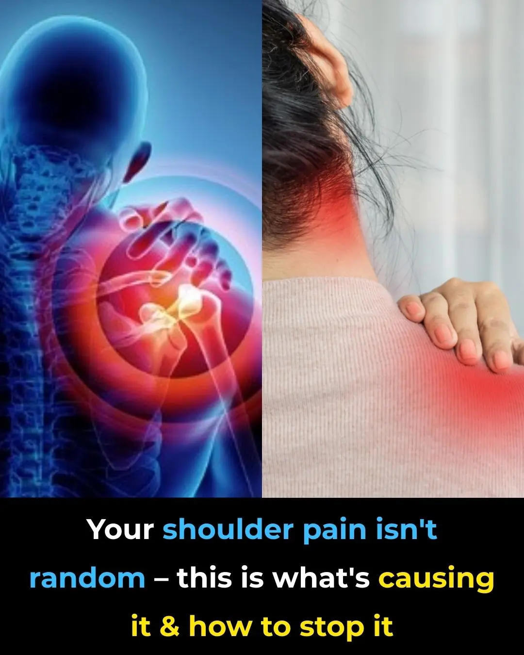 Shoulder Pain from Sleeping: Causes, Solutions and More