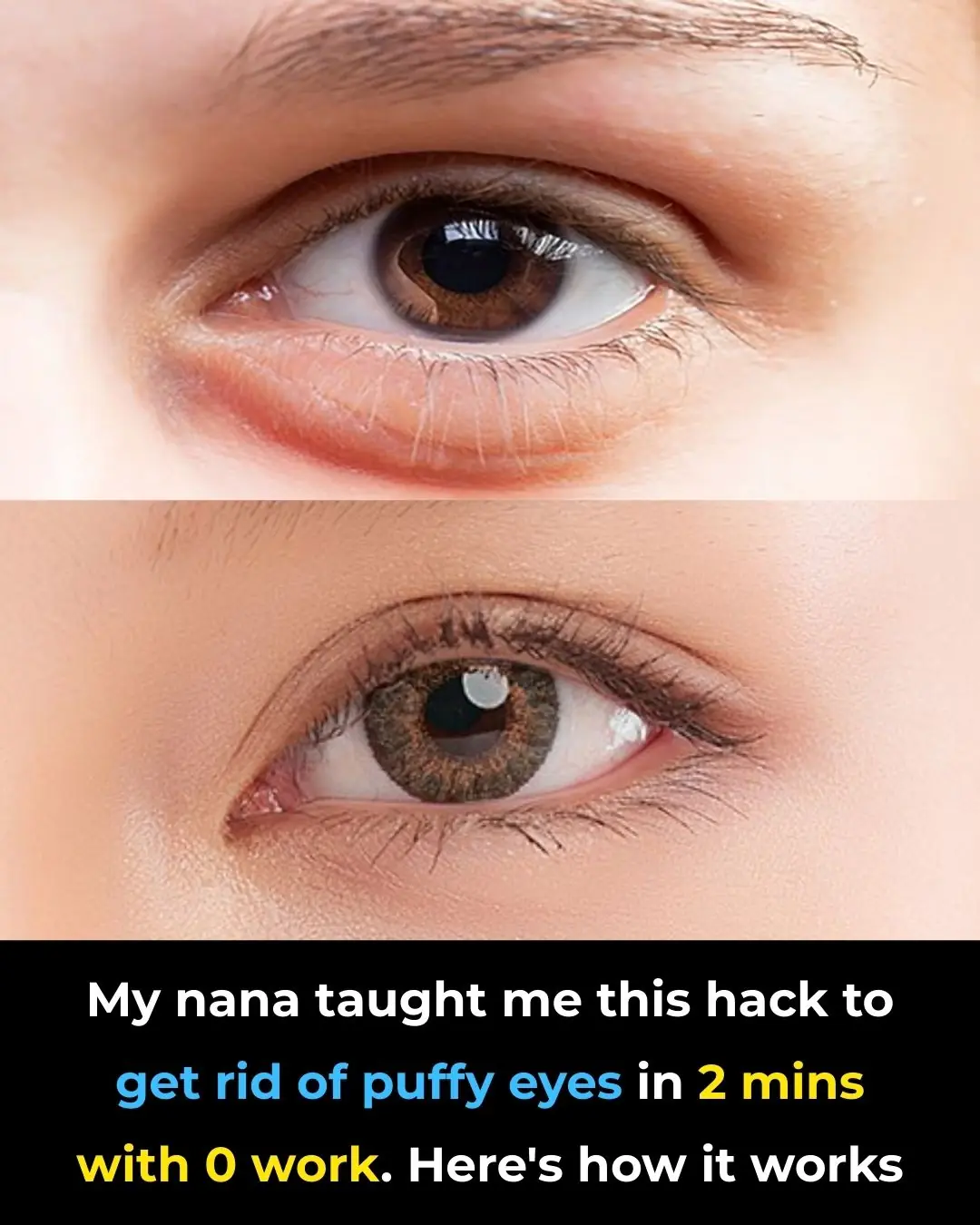 My nana taught me this hack to get rid of puffy eyes in 2 mins with 0 work. Here’s how it works