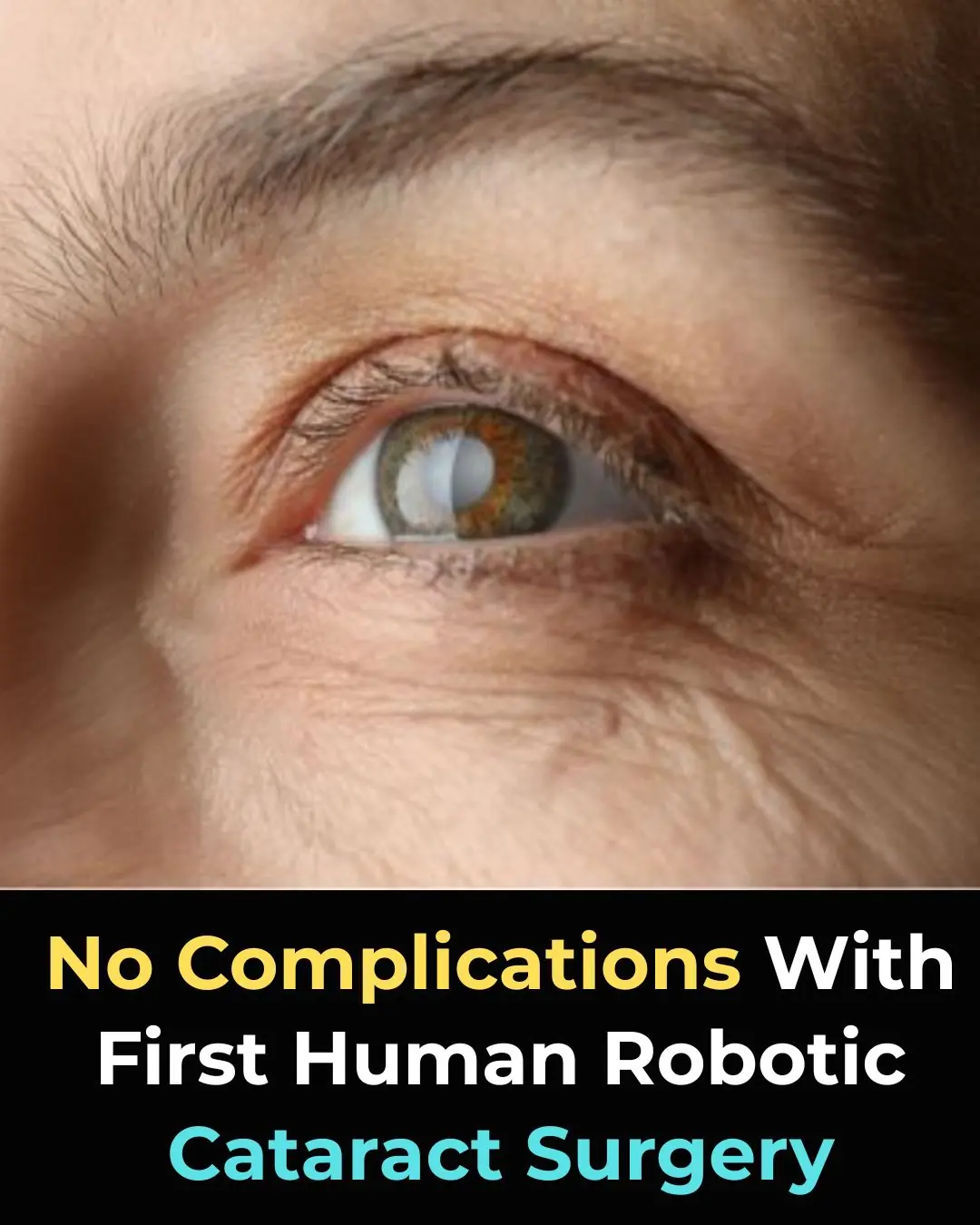 First Human Trial of Robotic-Assisted Cataract Surgery Reports No Treatment-Related Complications