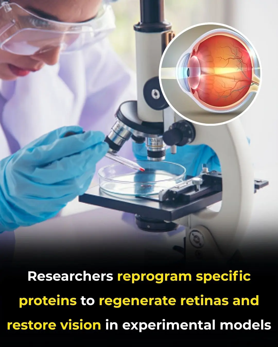 Researchers Find Method to Trigger Retinal Repair Without Stem Cells