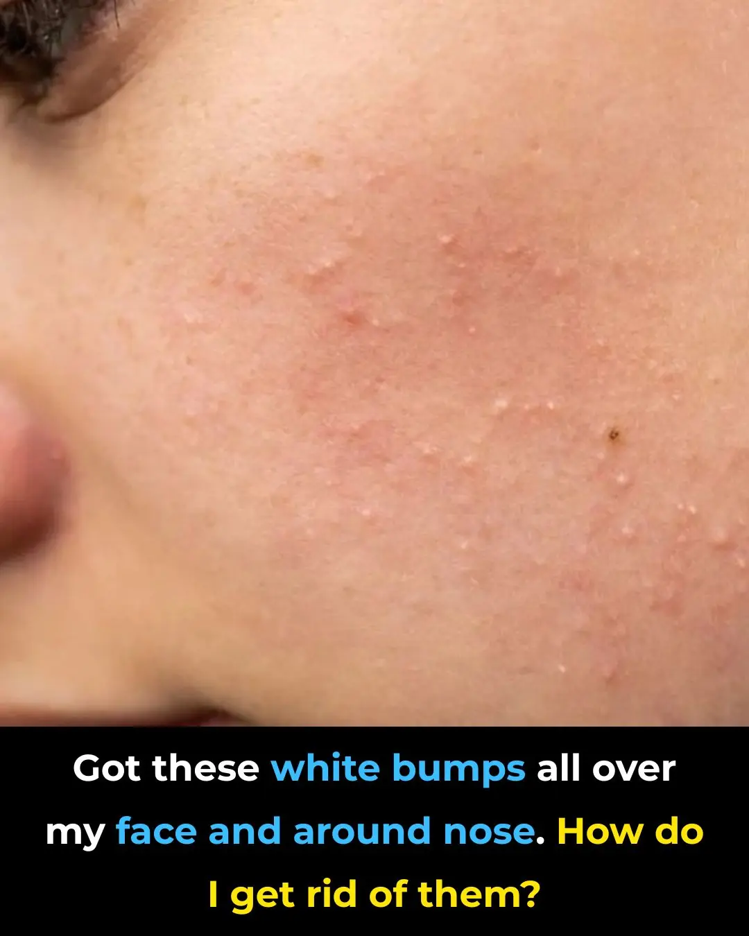 I truly am bothered by these!