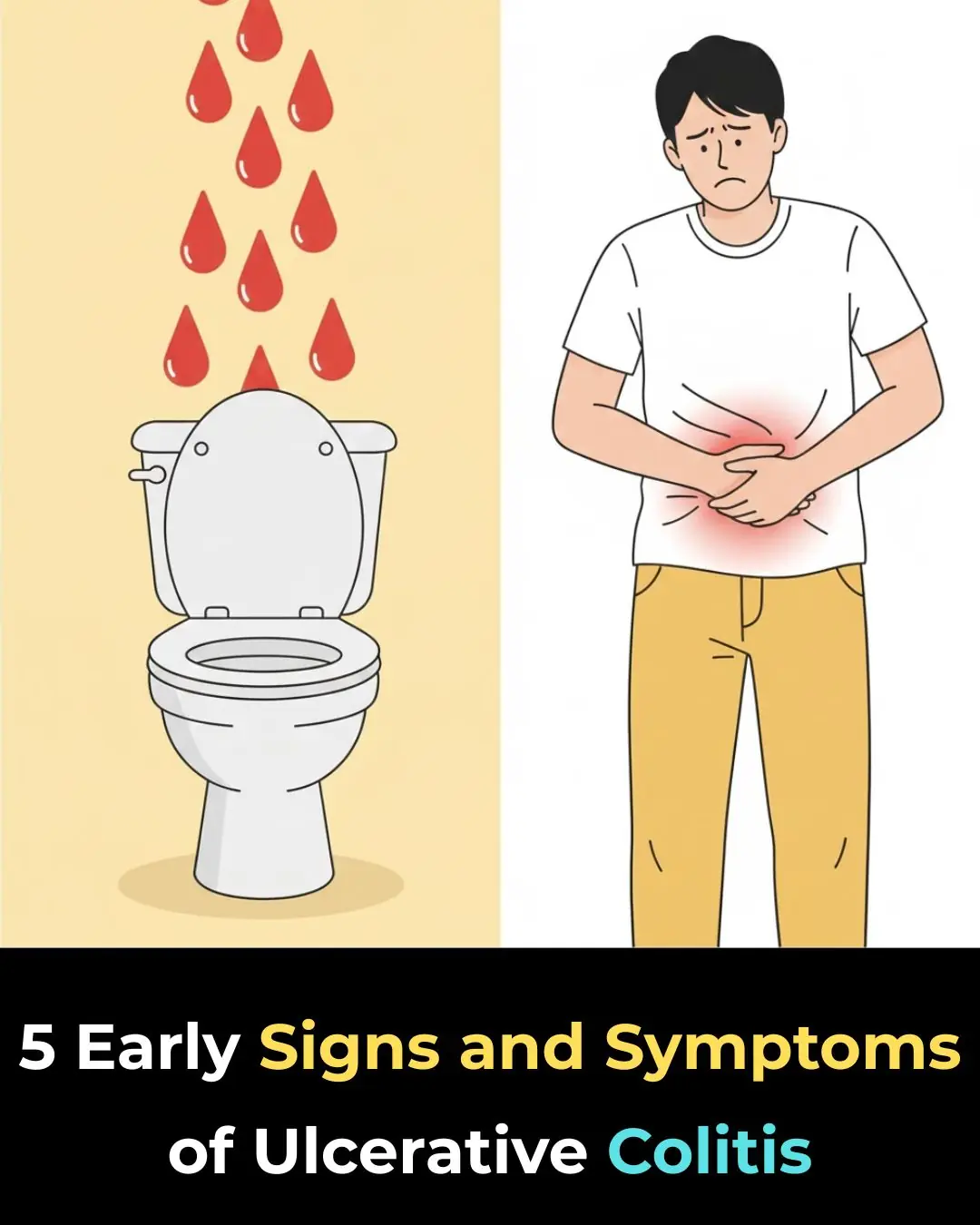 5 Early Signs and Symptoms of Ulcerative Colitis