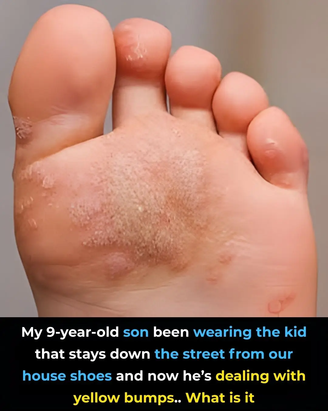 These are the consequences of wearing used…