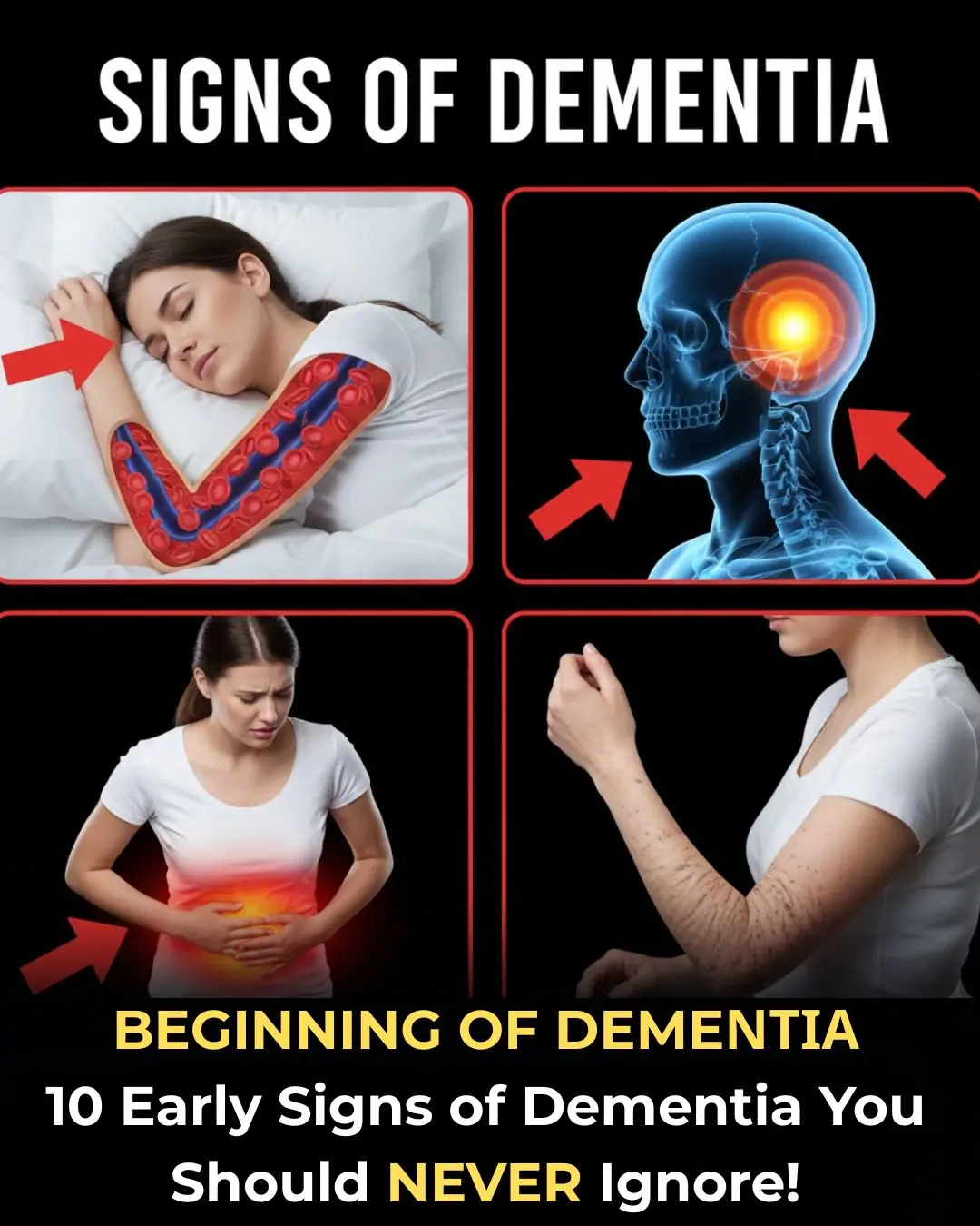 Over 60? 10 Early Dementia Warning Signs You Must NEVER Ignore (Catch Them Before It’s Too Late)