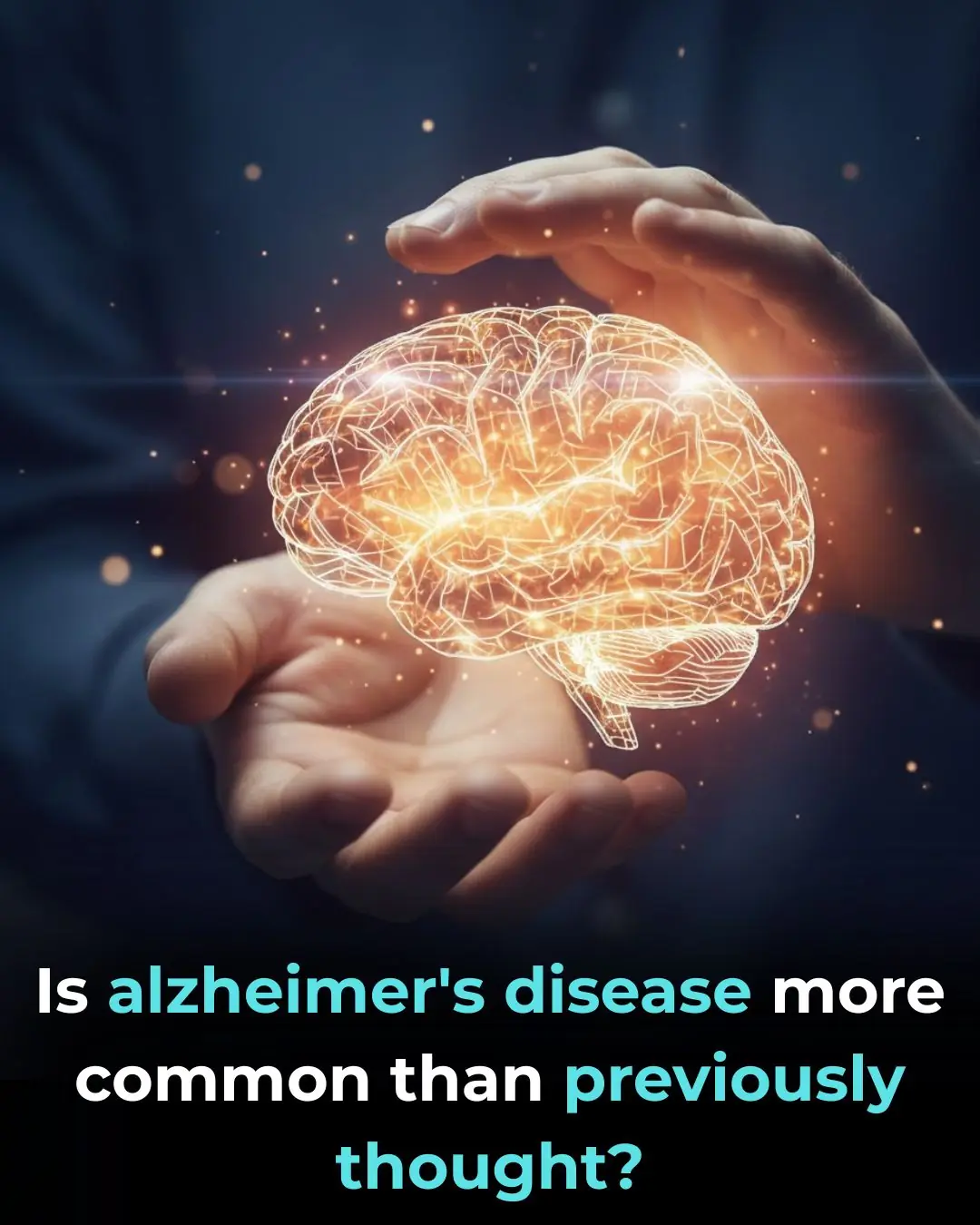 Is Alzheimerâs Disease More Common Than Previously Thought?