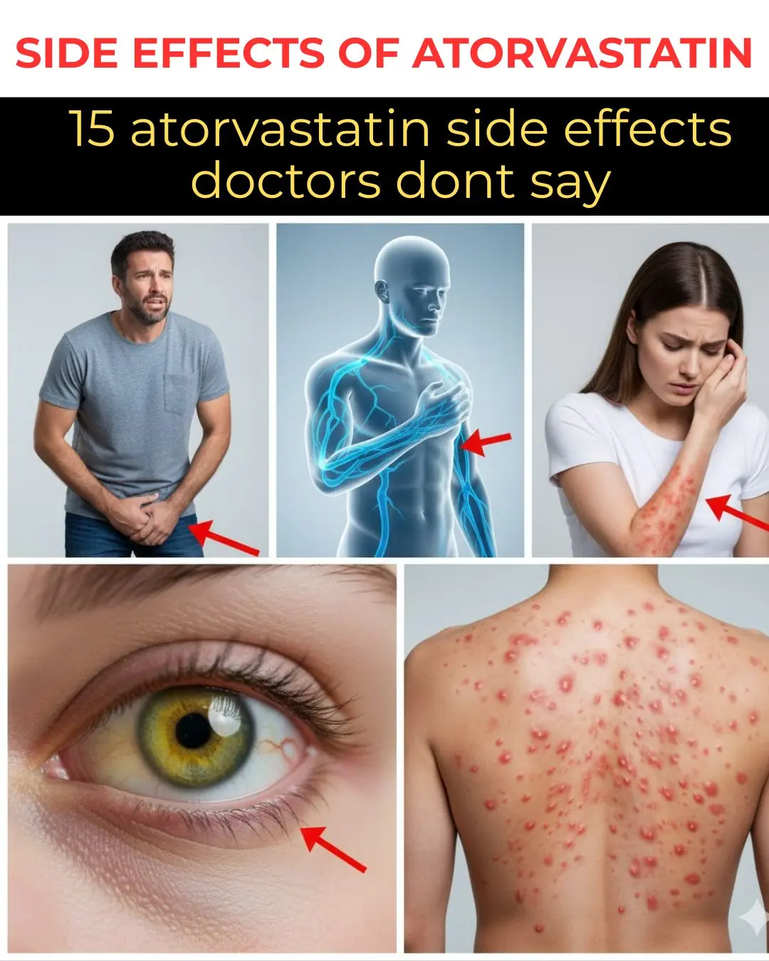15 Hidden Atorvastatin Side Effects Your Doctor May Not Have Time to Mention (But You Deserve to Know Before Your Next Refill)