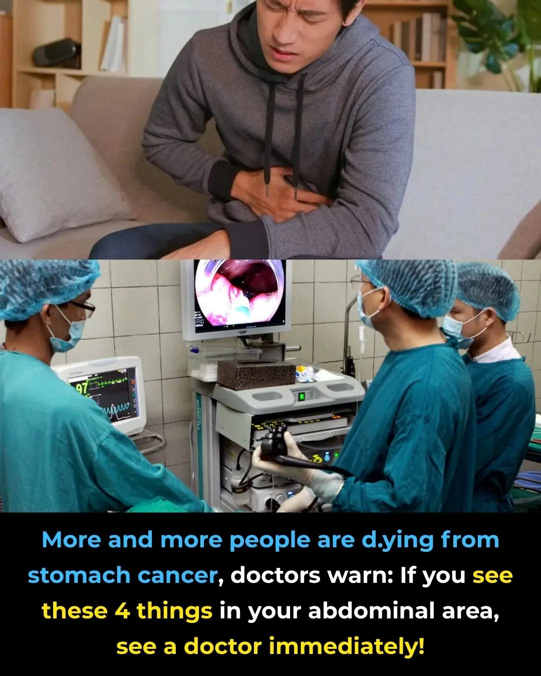 Rising Deaths From Stomach Cancer: Doctors Warn — See These 4 Abdominal Signs and Seek Medical Care Immediately