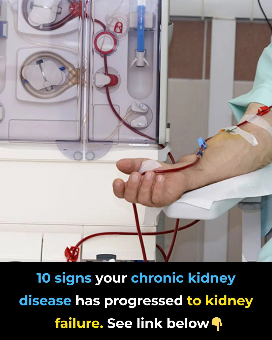 What To Know About Chronic Kidney Failure