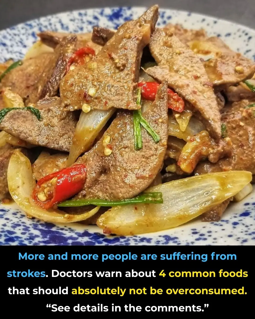 Rising Stroke Rates: Doctors Warn Against Overusing Four Common Foods