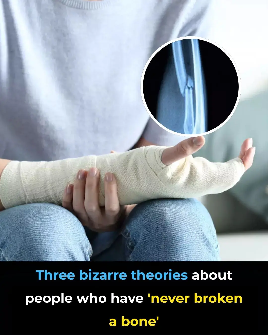 Bizarre theories about people who have ‘never broken a bone’