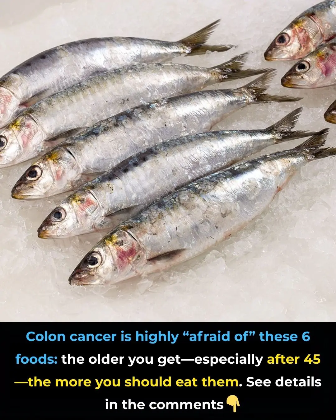 Six Foods That May Help Prevent Colorectal Cancer — Especially After Age 45