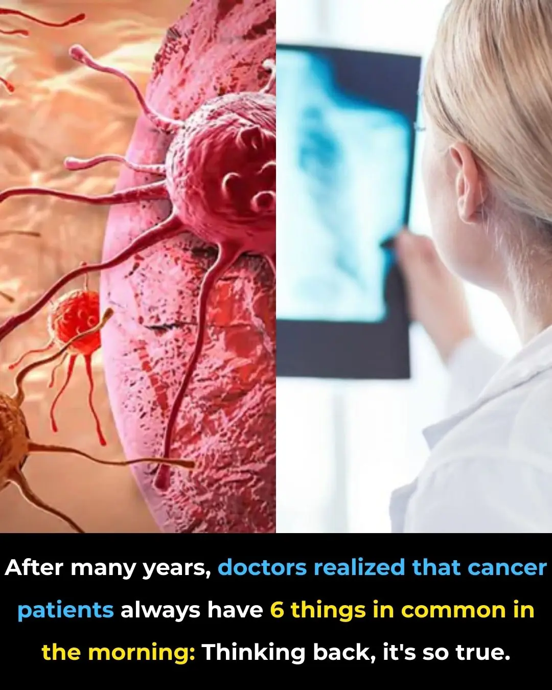 After Many Years of Practice, Doctors Noticed Six Common Morning Habits Among Cancer Patients