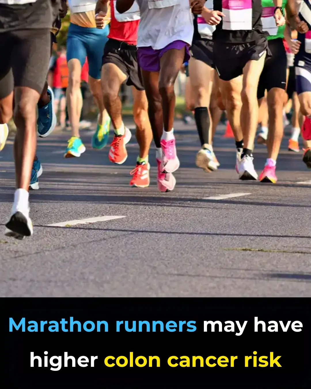 Intensive Long-Distance Running and Colon Health: Emerging Evidence of Increased Risk for Advanced Adenomas