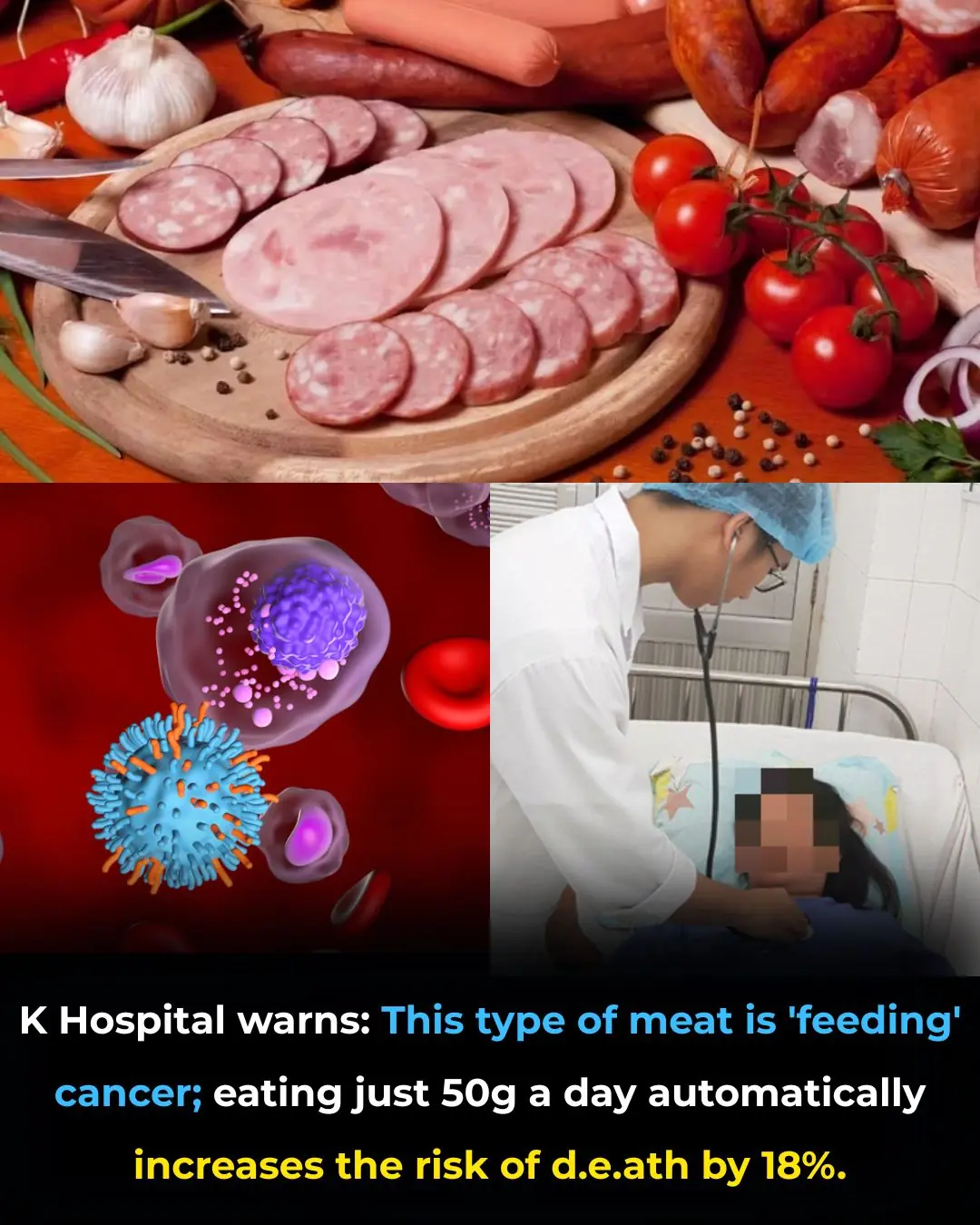 Red and Processed Meat Consumption Increases Cancer Risk, Experts Warn