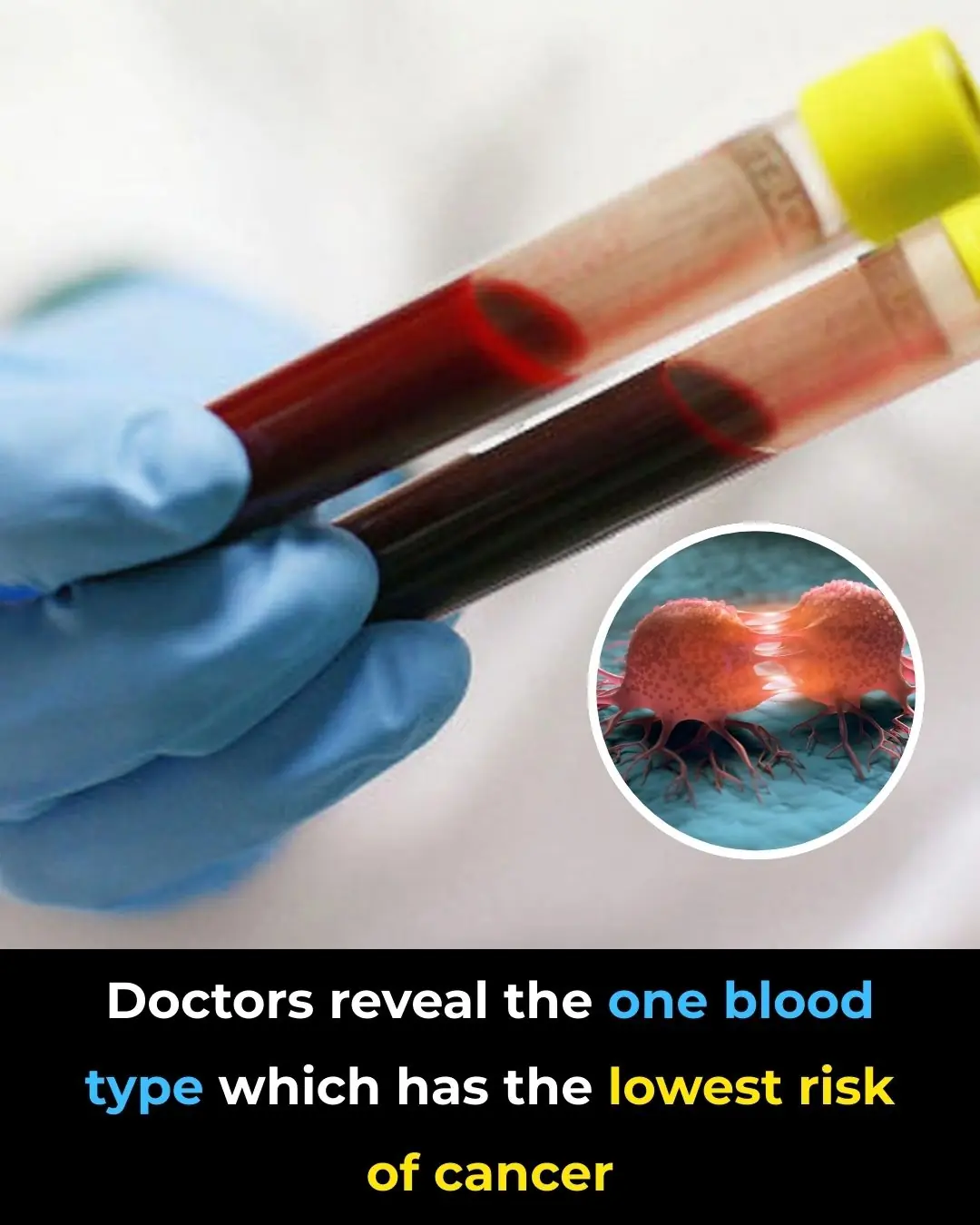 Understanding the Link Between Your Blood Type and Health