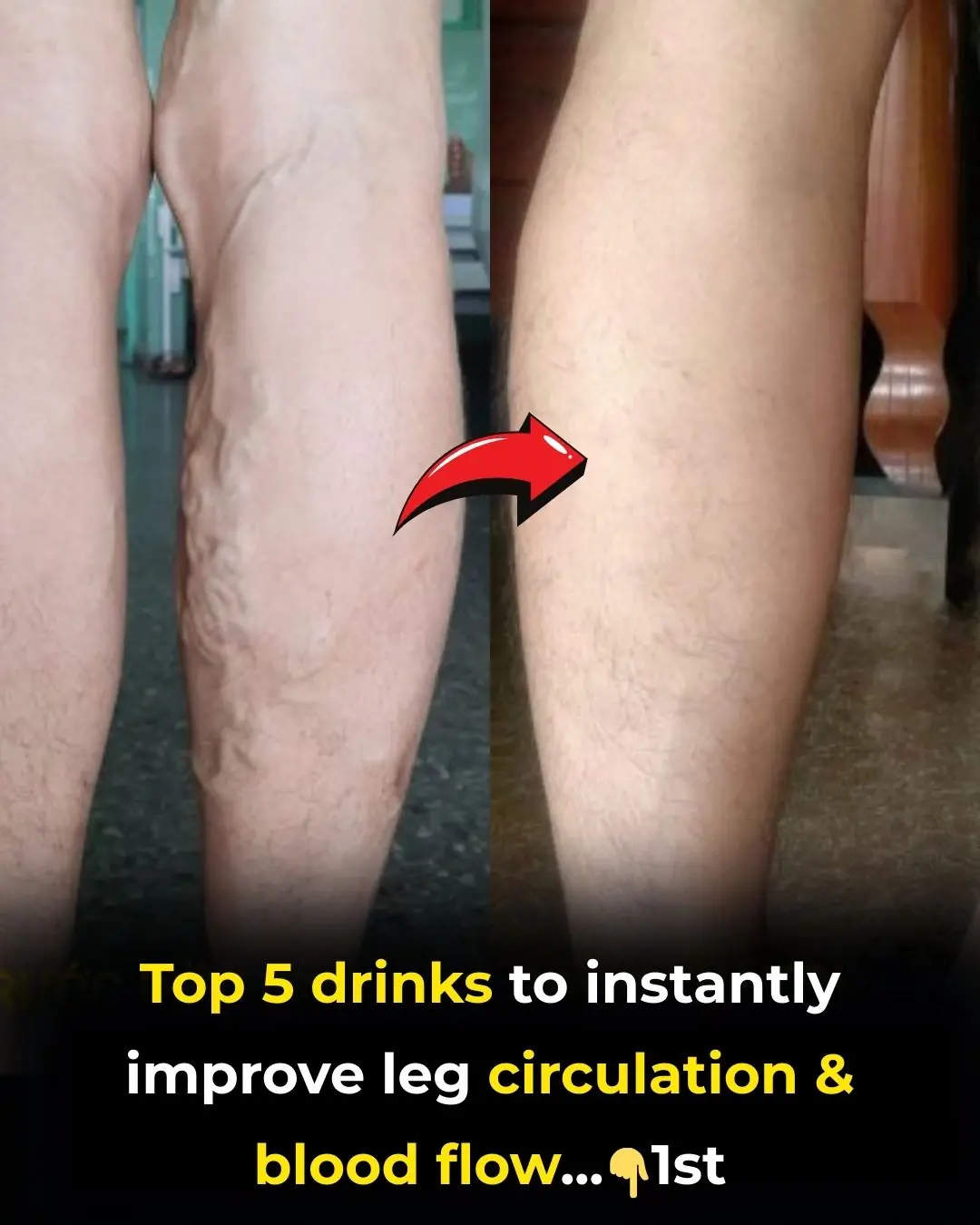 Top 5 drinks to INSTANTLY improve leg circulation and blood flow