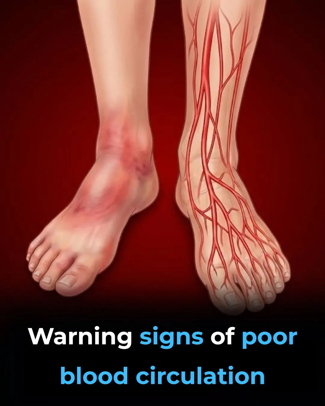 16 Warning Signs of Poor Blood Circulation and How to Treat It
