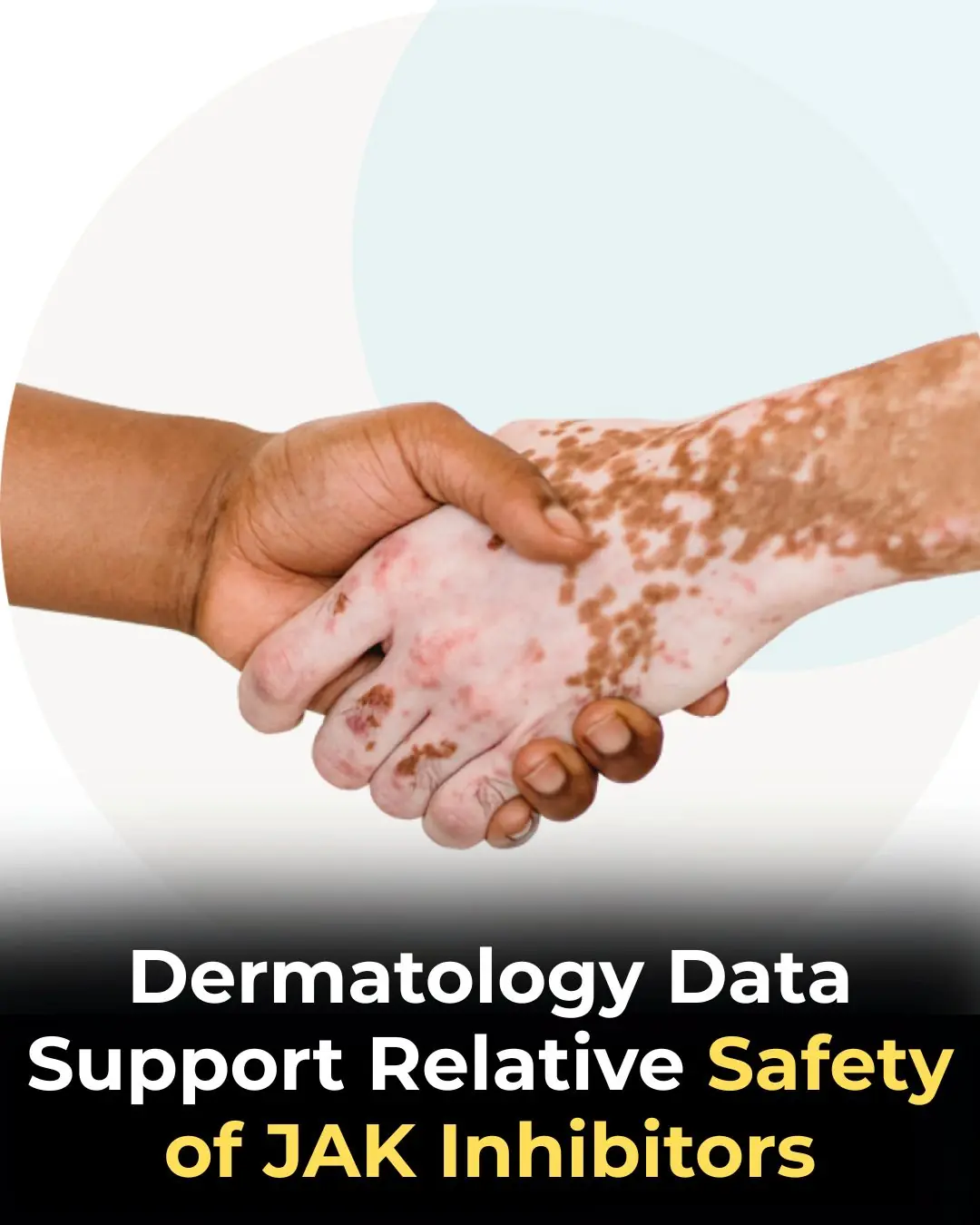 Dermatology Data Reinforce the Relative Safety of JAK Inhibitors