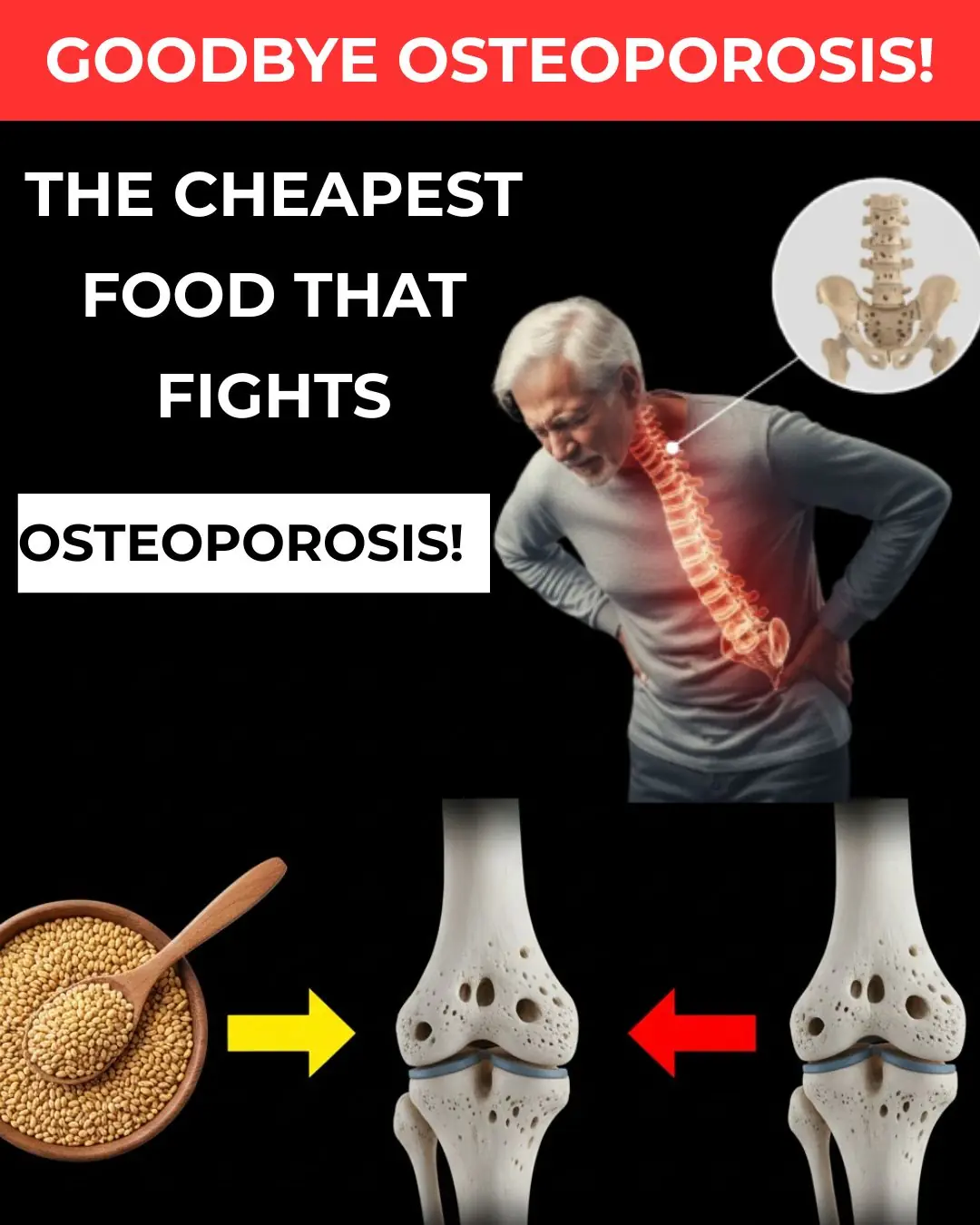 The Most Affordable Food That Supports Bone Health and Helps Fight Osteoporosis