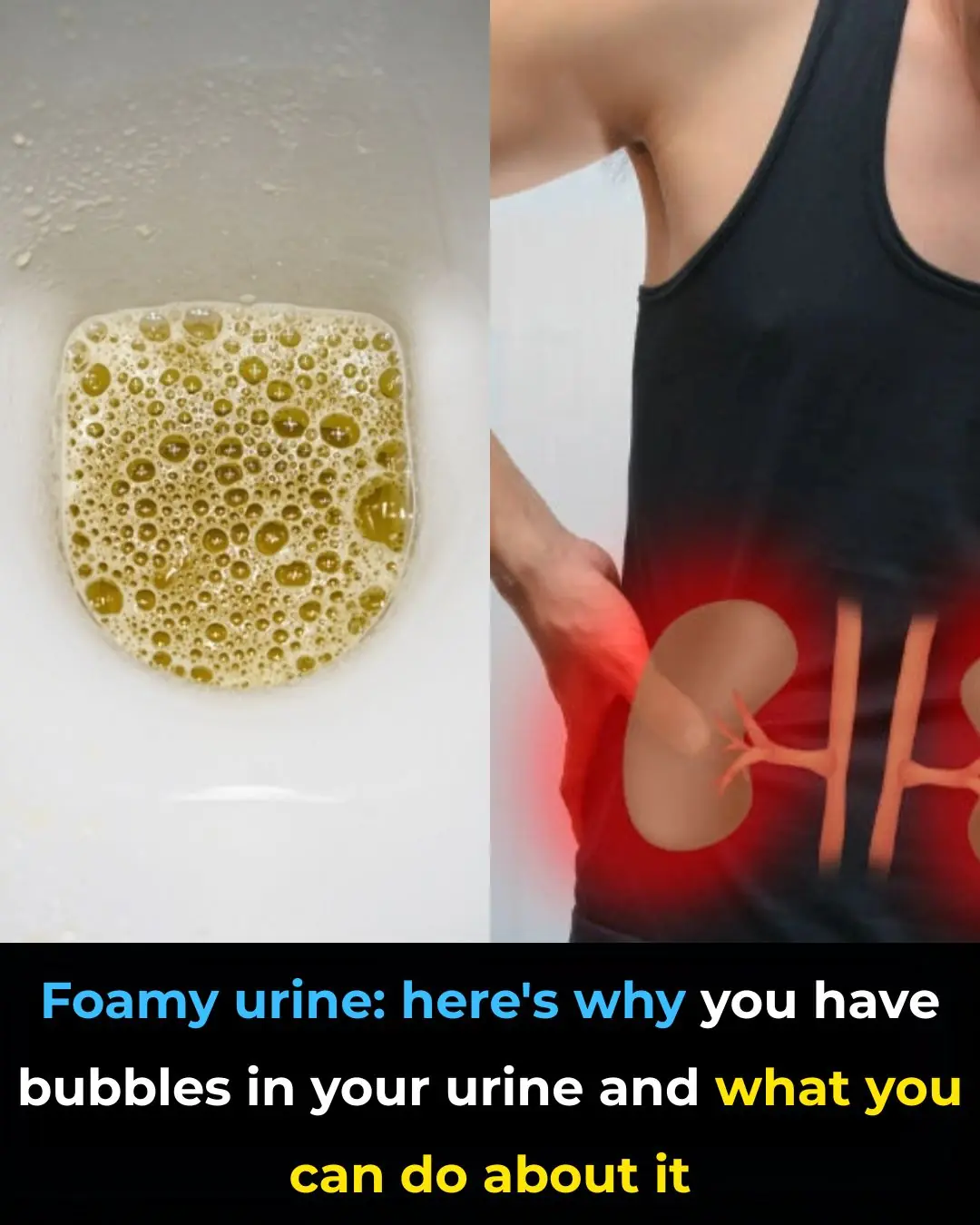 Foamy Urine: Here’s Why You Have Bubbles in Your Urine