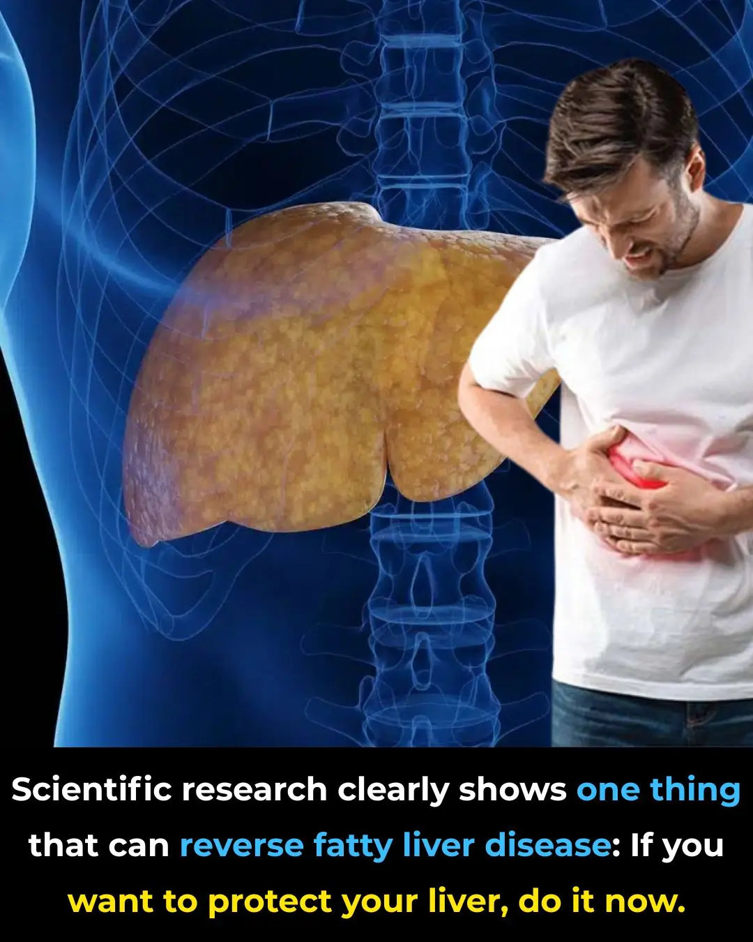 Scientific Research Identifies One Simple Action That Can Reverse Fatty Liver Disease