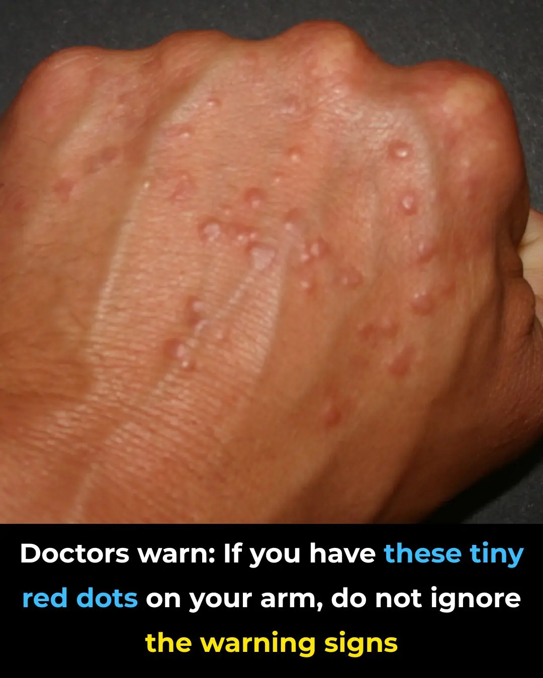 Don’t overlook these small red spots on your arm – They could be important warning signs