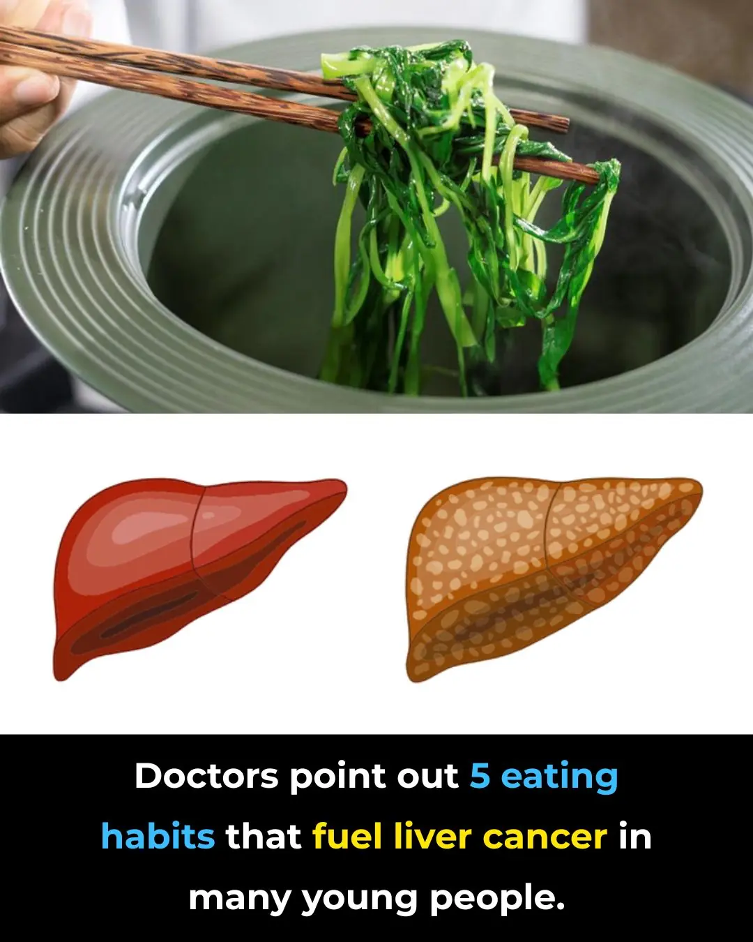 Doctors Warn: Unhealthy Eating Habits That Fuel Liver Cancer in Young People