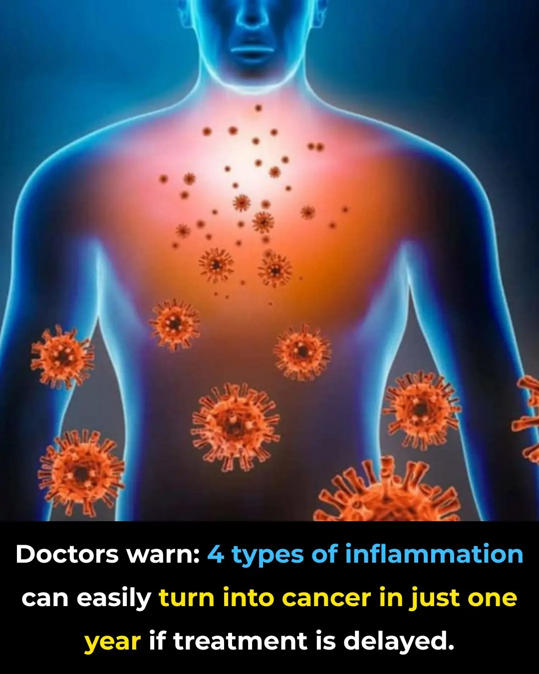Doctors Warn: Four Types of Inflammation That Can Turn Into Cancer Within a Year if Treatment Is Delayed