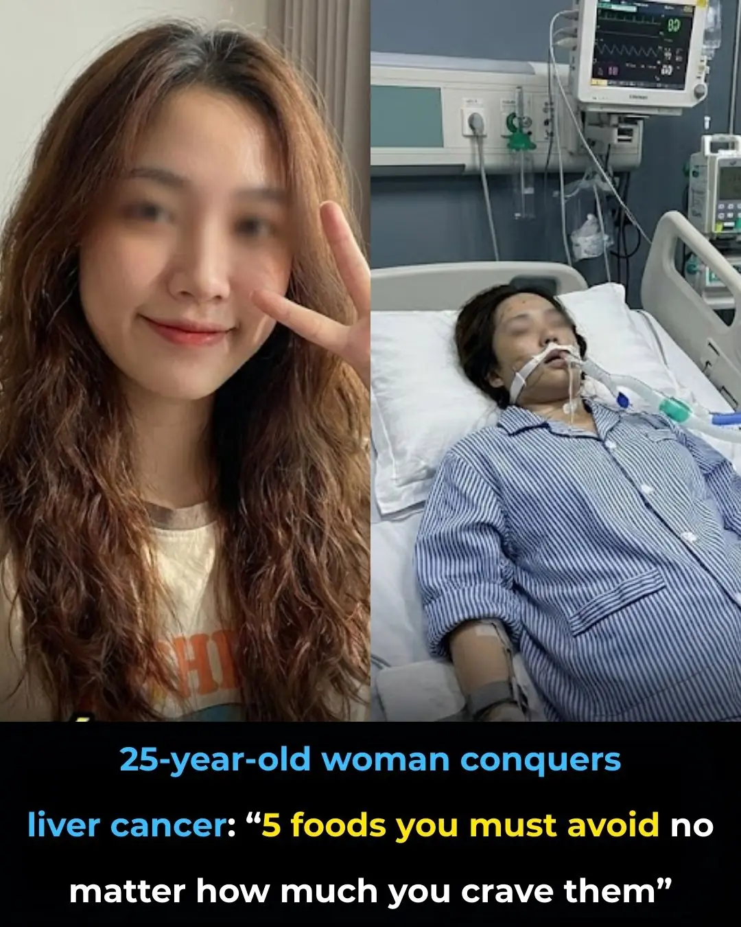 25-Year-Old Woman Who Overcame Liver Cancer: “5 Foods You Must Avoid No Matter How Much You Crave Them”