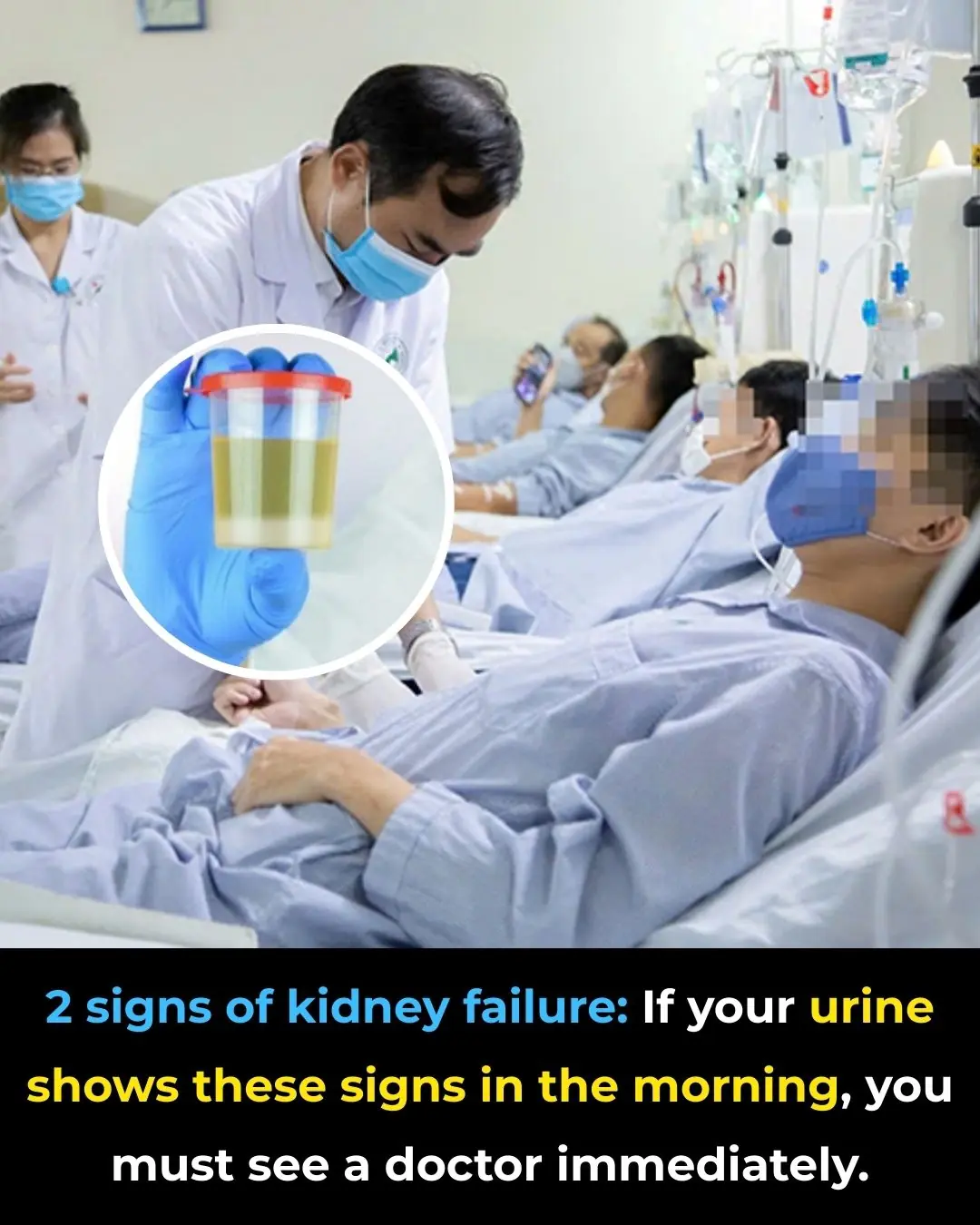 Morning Urine Warning Signs That Should Not Be Ignored