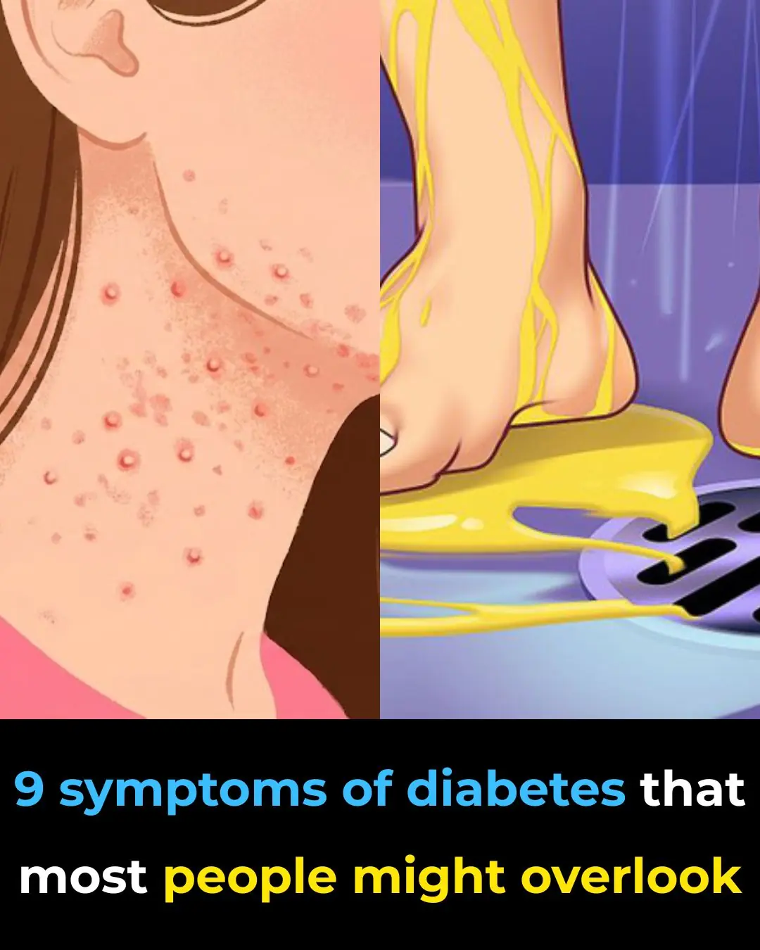 Could You Have Diabetes? 9 Symptoms Many Overlook in Their 20s and 30s