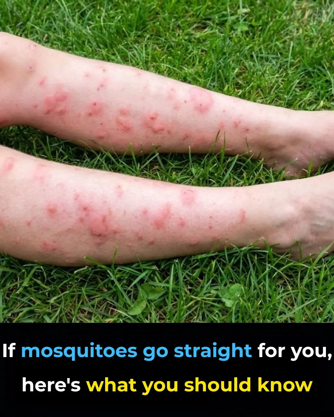 If mosquitoes go straight for you, here's what you should know