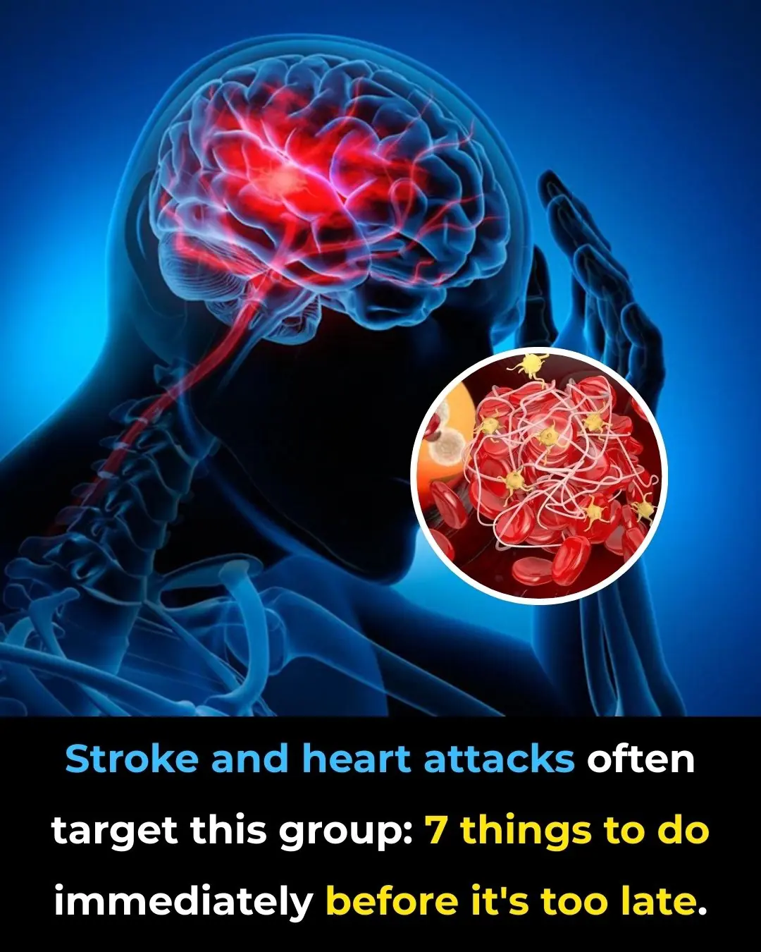 High Blood Pressure and the Risk of Stroke and Heart Attack: 7 Actions to Take Before It’s Too Late