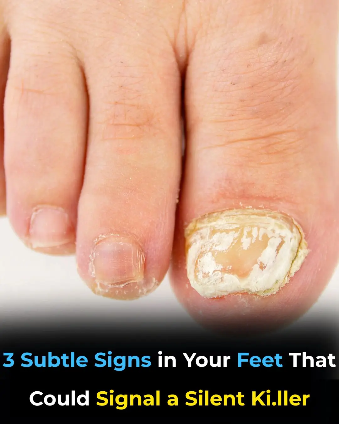 3 Subtle Signs in Your Feet That Could Signal a Silent Killer