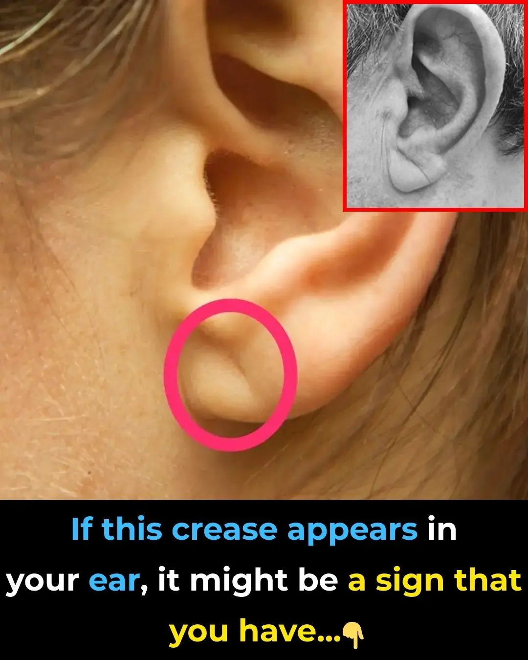 If You Notice This Sign on Your Ear, Here’s What It Could Mean