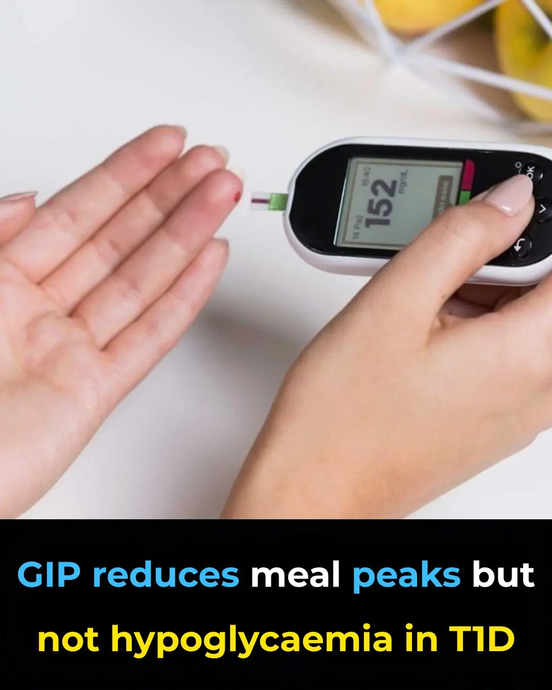 GIP Reduces Postprandial Glucose Peaks but Does Not Prevent Hypoglycaemia in Men With Type 1 Diabetes