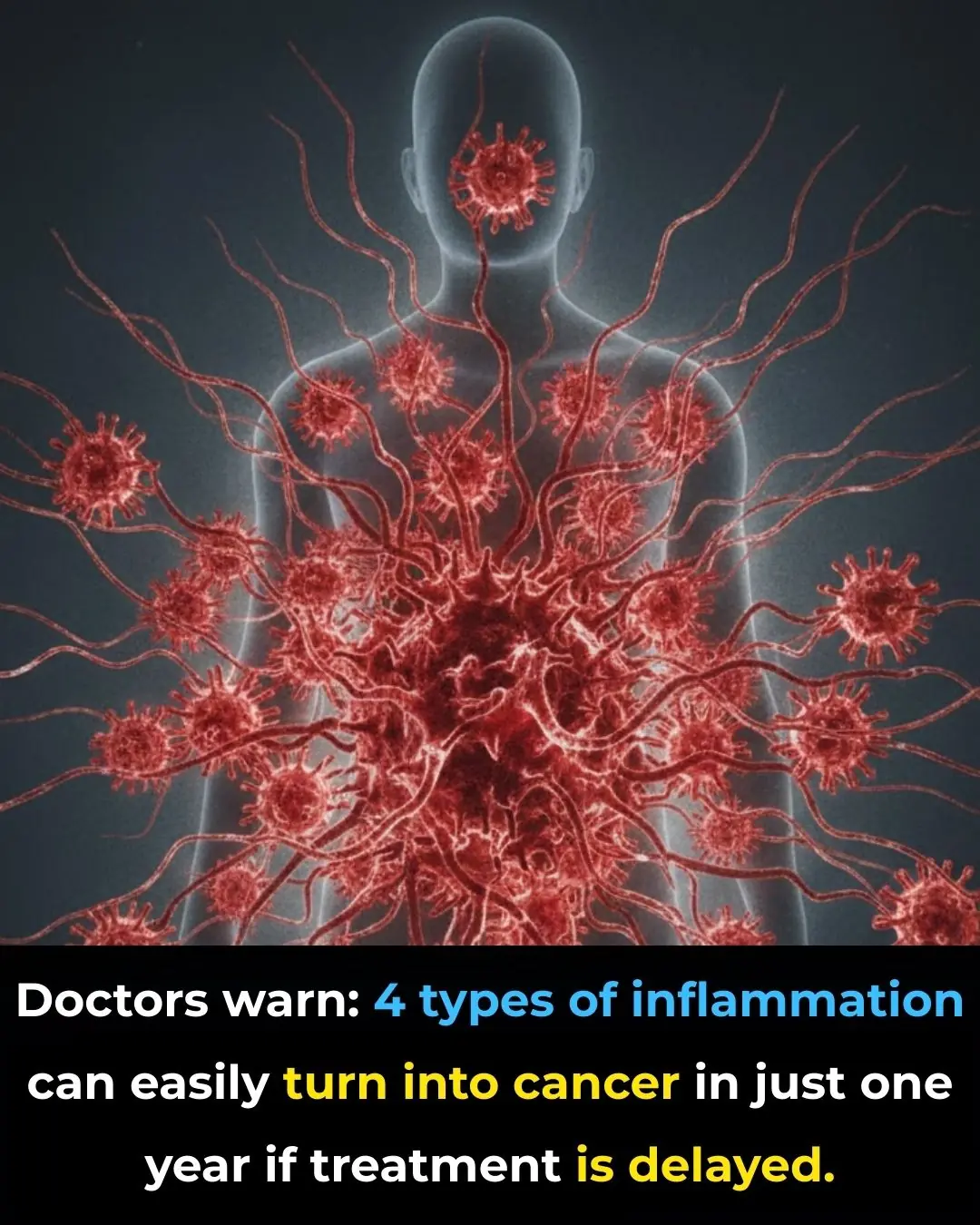 Doctors warn: 4 types of inflammation can easily turn into cancer in just one year if treatment is delayed