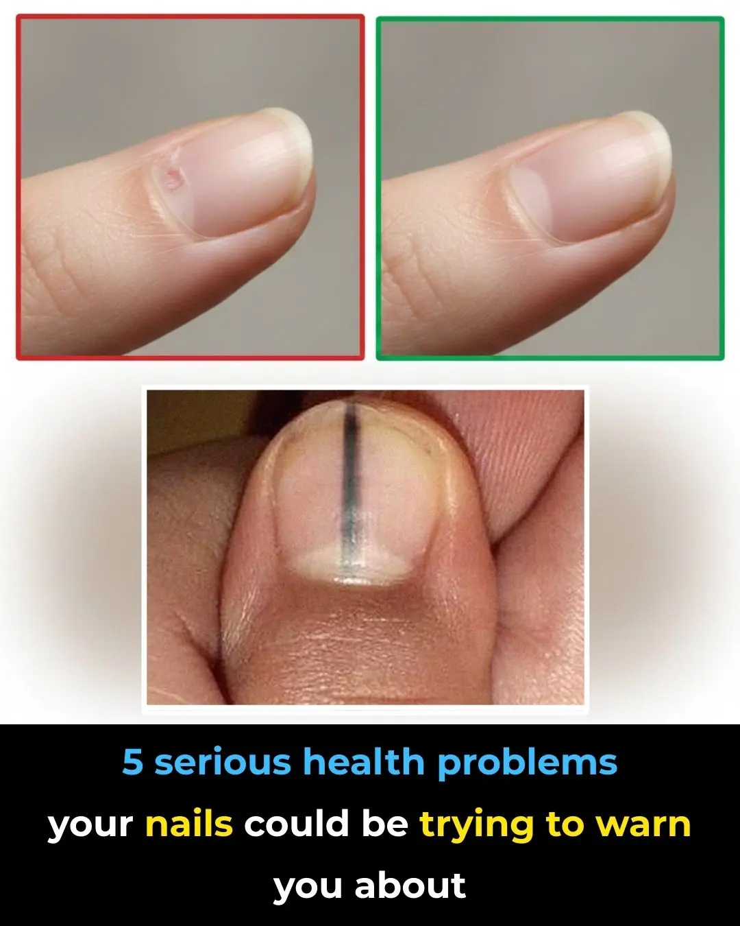 Nail Clues: 5 Health Problems You Shouldn’t Ignore