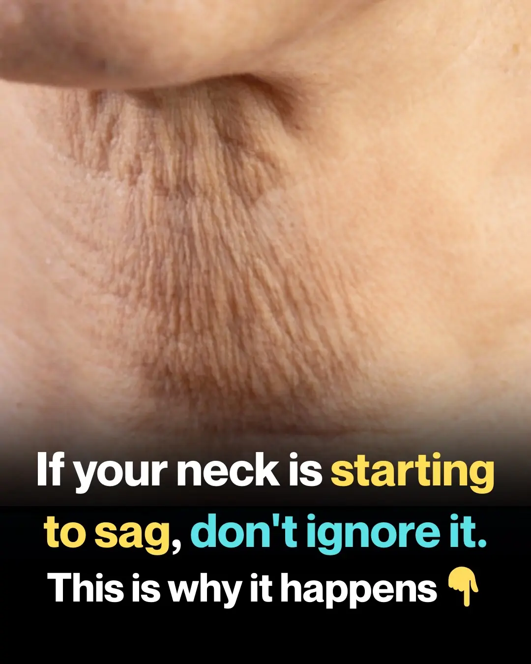 Why Neck Skin Sags as We Age