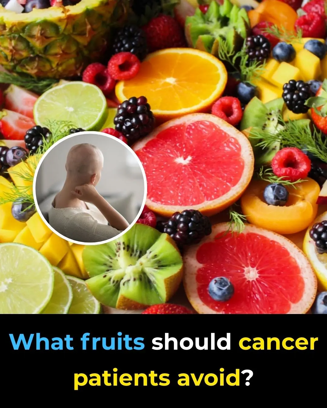 Which Fruits Should Cancer Patients Avoid? Dietary Guidance During Cancer Treatment