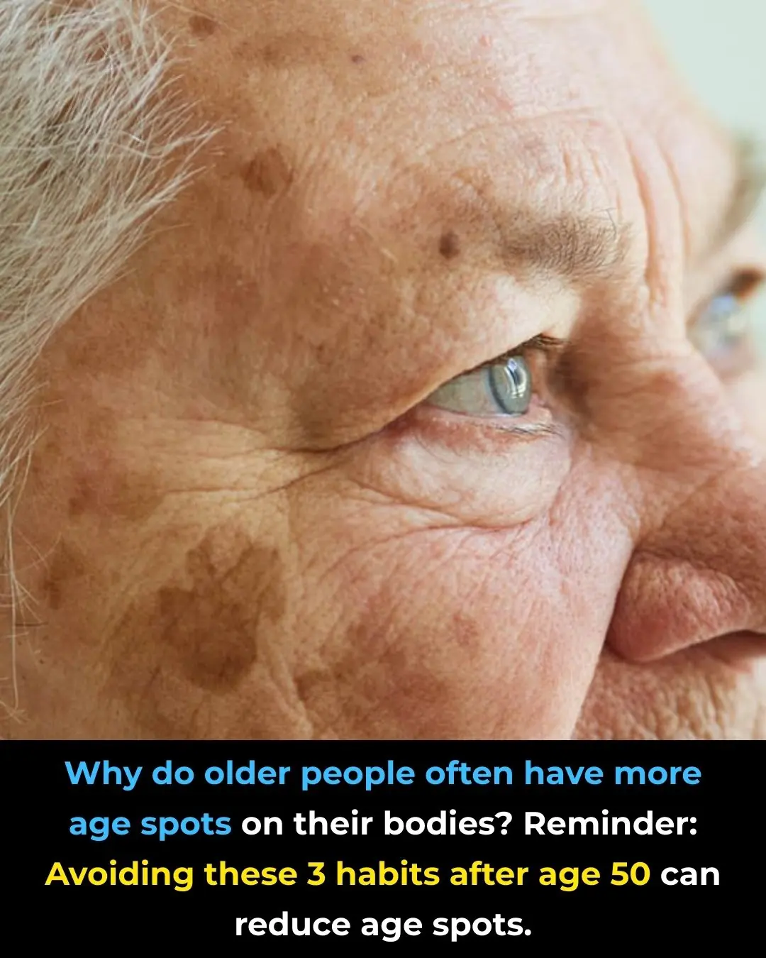 Why Do Older People Often Have More Age Spots on Their Skin?