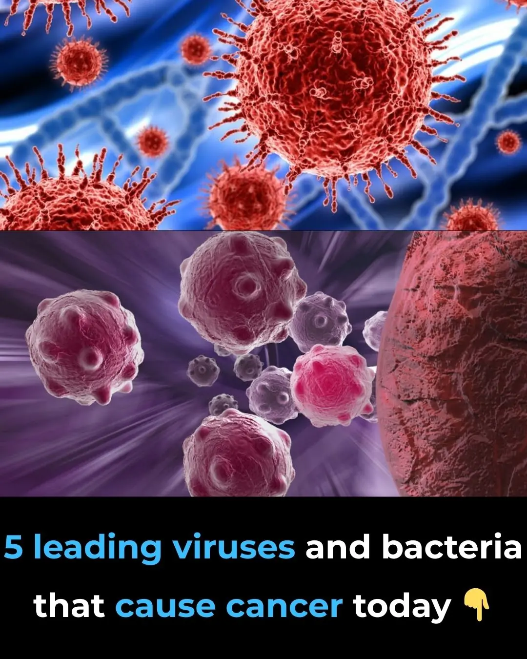 The Top 5 Viruses and Bacteria Linked to Cancer Today