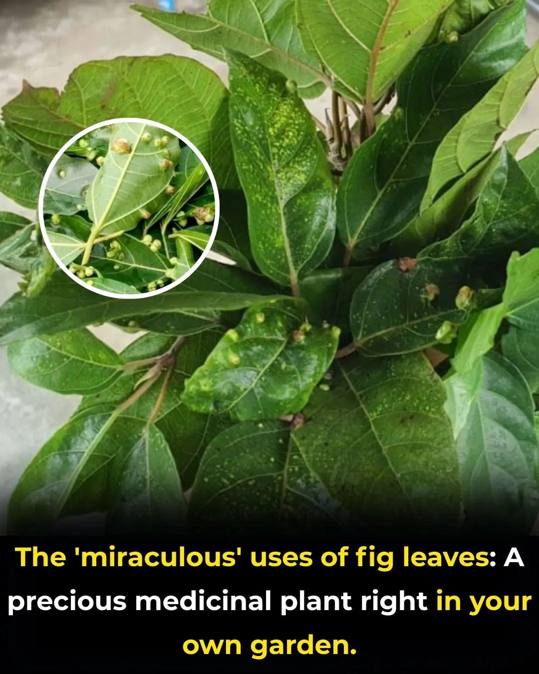 Fig Leaves: A Valuable Medicinal Plant in the Home Garden