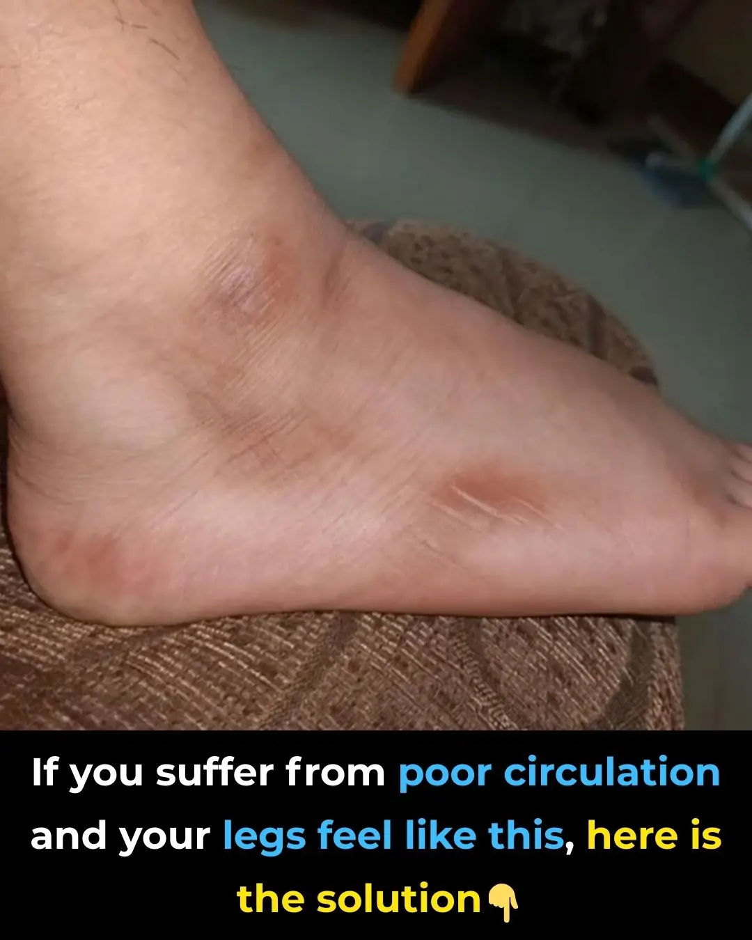 🩺 If Your Legs Feel Heavy, Cold, or Tingly—Here’s What It Means (And How to Improve Circulation Naturally)