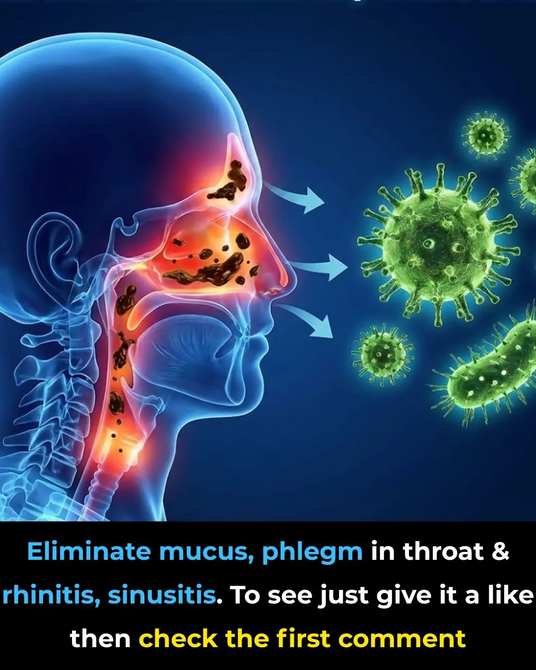 Eliminate Mucus, Phlegm in the Throat and Nose, and Rhinitis Naturally: Powerful Home Remedies