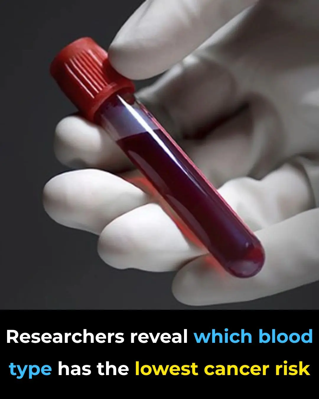 He Is the Least Likely to Have This Health Problem, According to Researchers