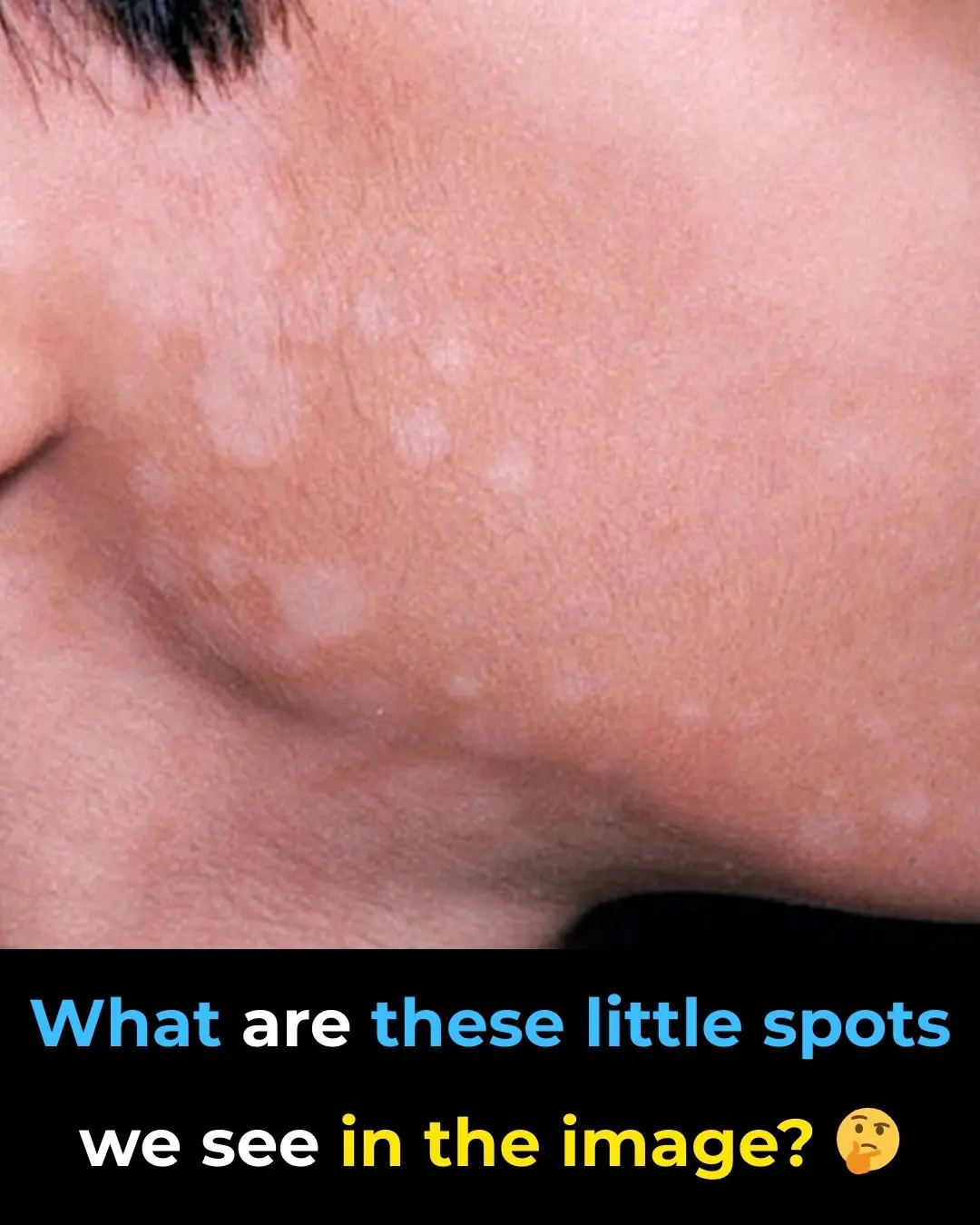 "What Are These Spots in the Image? 🤔"